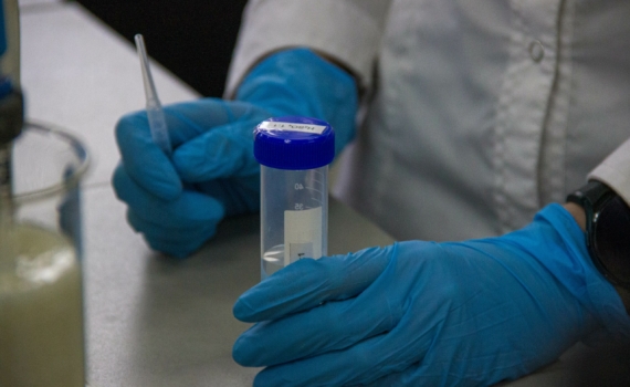 Роспотребнадзор отслеживает ситуацию с распространением неизвестного заболевания в Конго Роспотребнадзор отслеживает ситуацию с распространением неизвестного заболевания в Конго